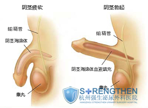 阴茎勃起障碍的治疗